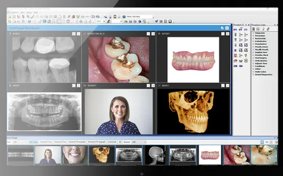 Dentrix